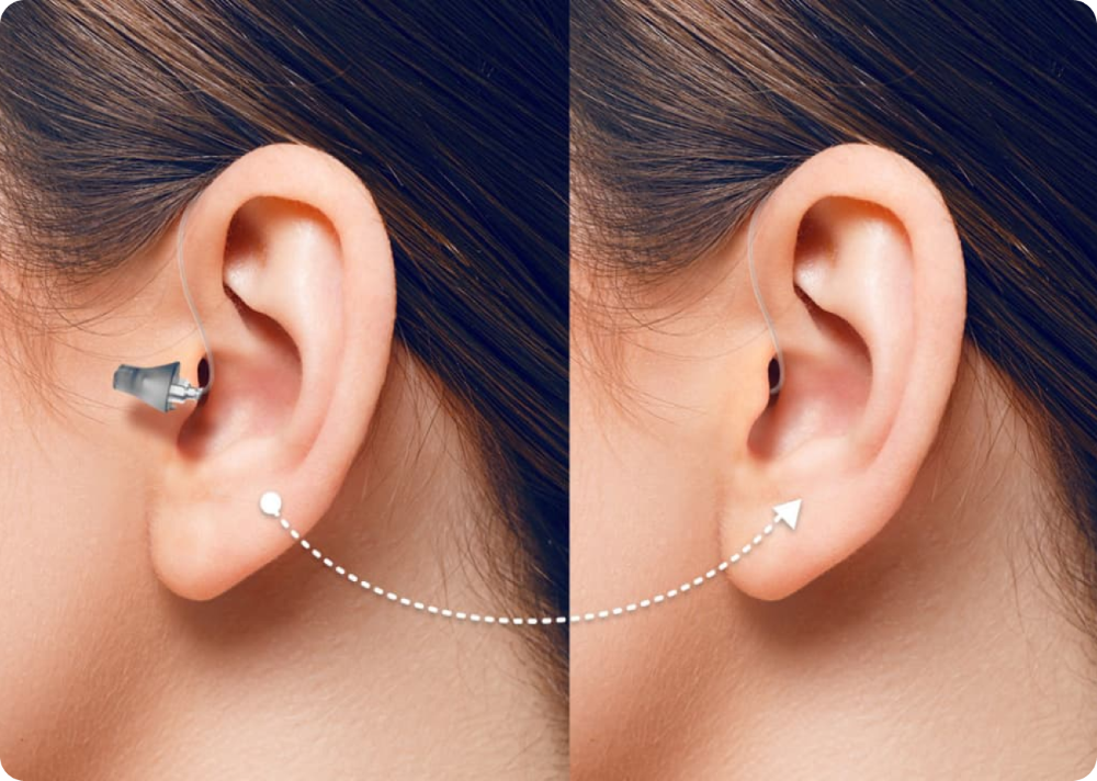 twee closeups van oor dat achter-het-oor gehoorapparaat draagt
